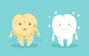 Teeth Bleaching