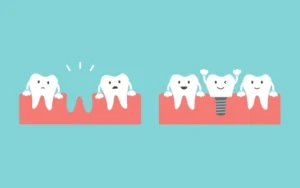 Extractions and Wisdom Teeth Removals Dapto