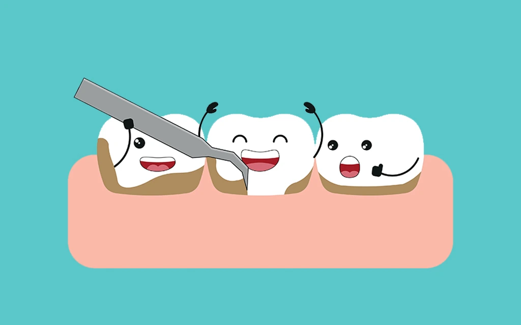 professional dental clean