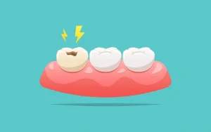 Tooth Cavity Pain