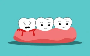 gum bleeding