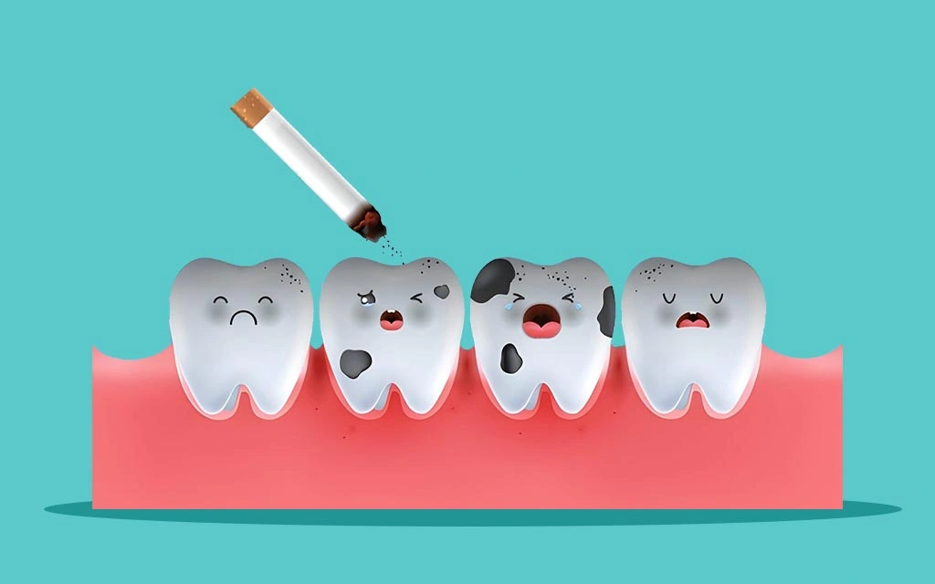 Smoking damaged teeth 