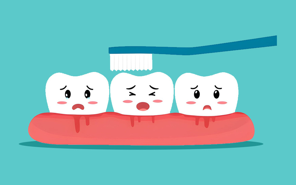  Pregnancy Gum Disease